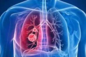 全球引發(fā)新冠肺炎HXQC再公告